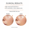 Clinical Results - Facial Hydration