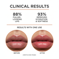 Clinical Results - Lip Treatment